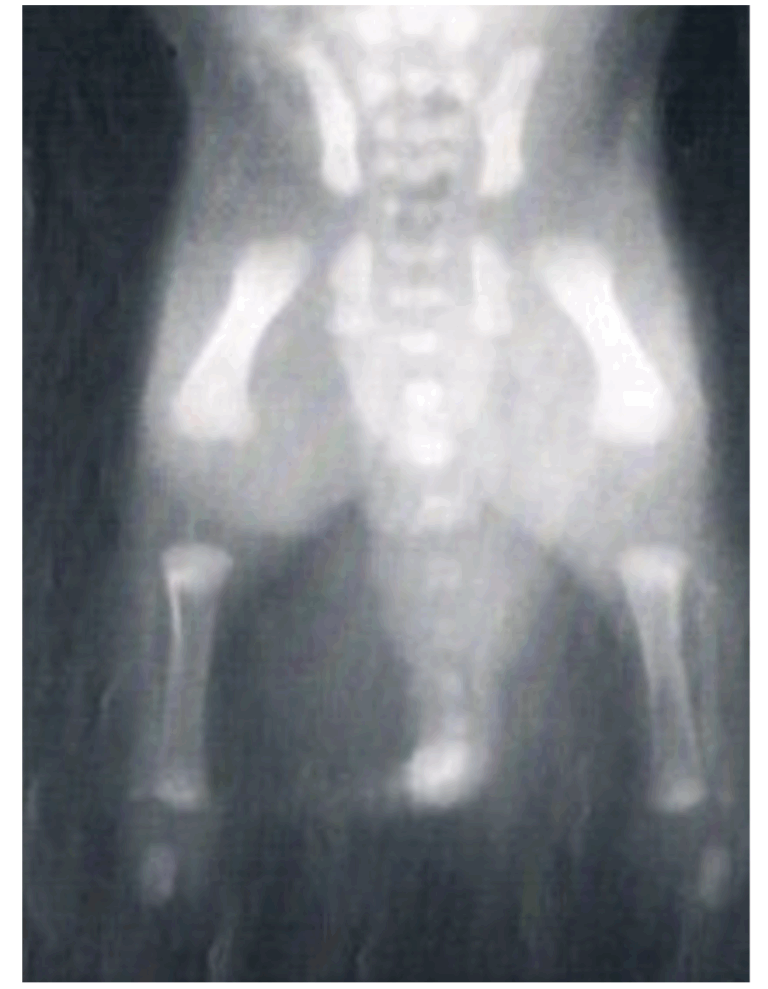 HD en ED bij Berners 3